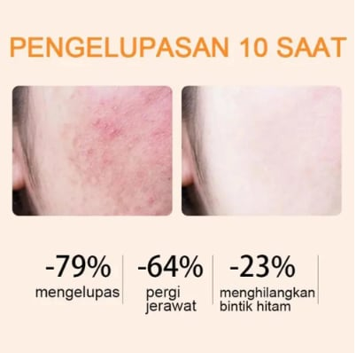 Orange Enzyme Exfoliating Gel-The Gentle Miracle Your Skin Has Been Crying Out For💥 The More You Buy, The Bigger You Save-Don’t Miss This Deal!
