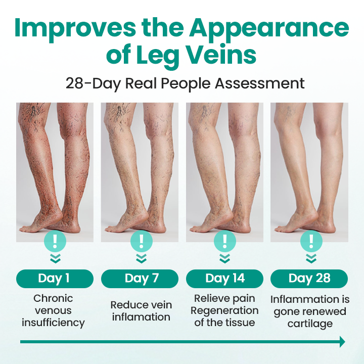 LegRenew Varicose Veins Microneedle Patch