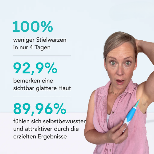 🔥LAST DAY 50% OFF⚡Skin Tag Remover - Skin Tag and Mole Remover for Home Use